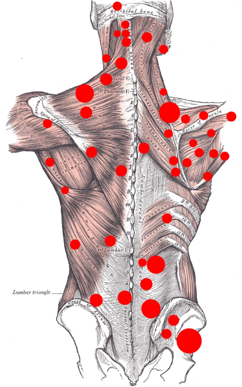 Trigger point pressure applied to forearm extensors